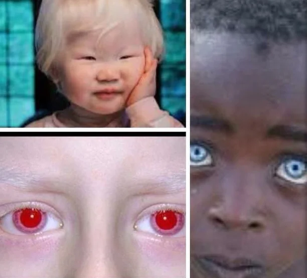 albino.jpg