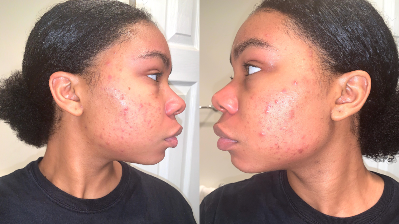 great barrier relief