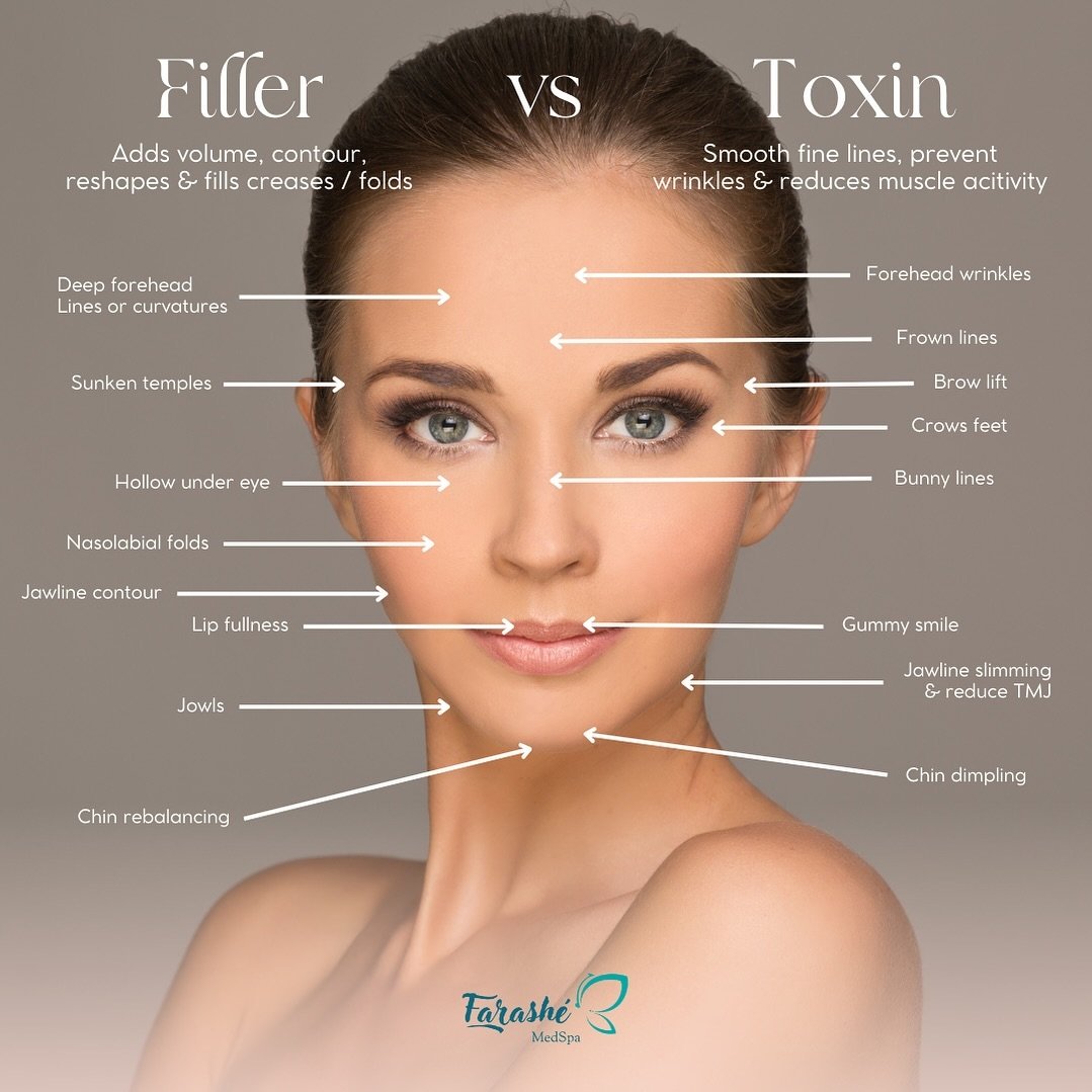 Discover the Difference: Filler vs Toxin. Filler adds volume and reshapes, while Toxin smooths lines and reduces muscle activity. Enhance your natural beauty with these treatments. Book your appointment for a consultation to achieve your desired look