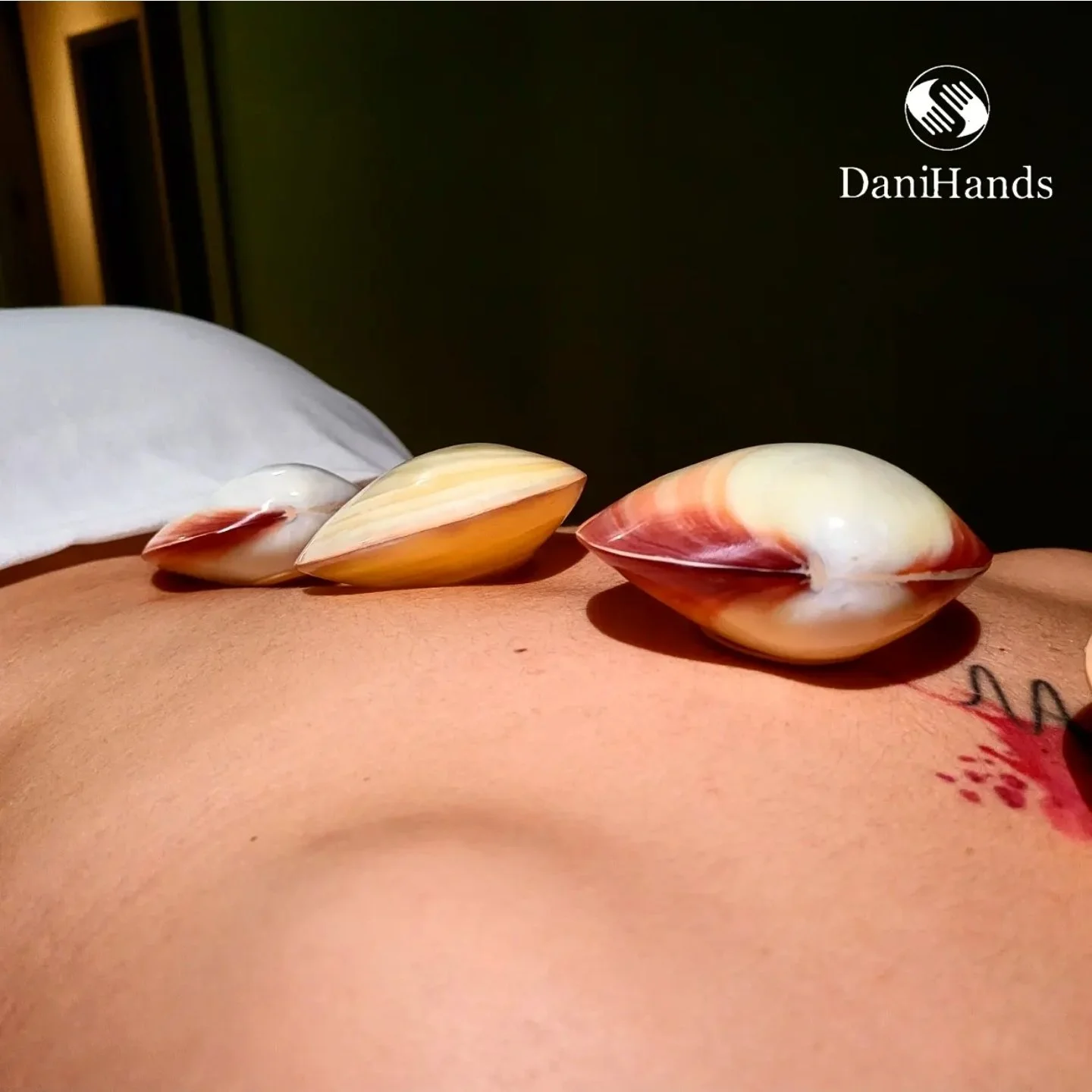 Three large seashells placed on a person's back with a dark background and a white pillow in the upper left corner.