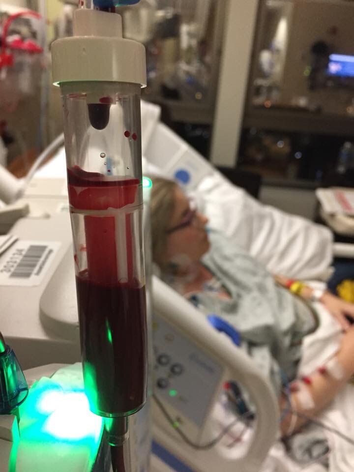 Receiving blood transfusion after liver transplant.JPG