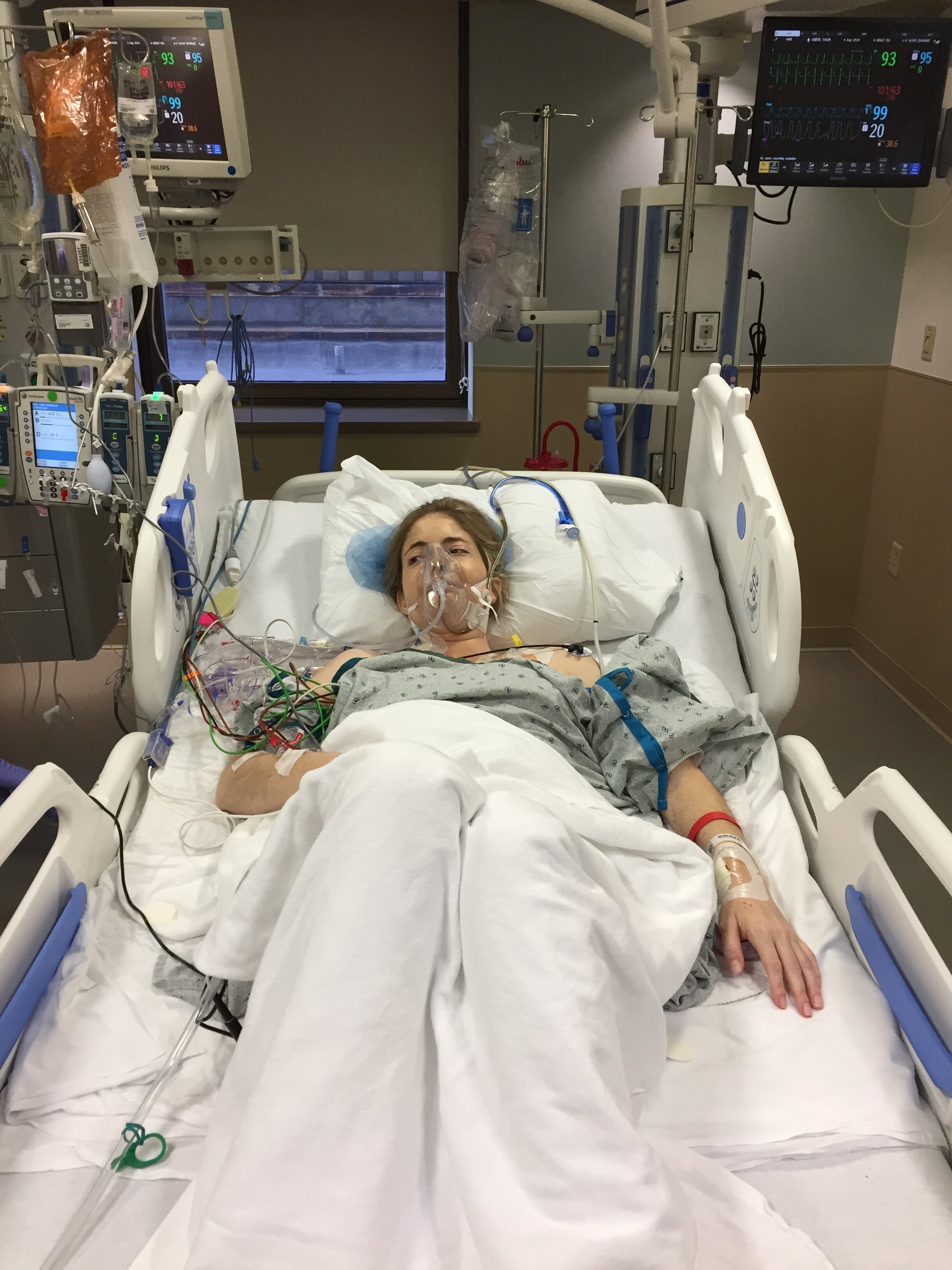 Waking up after liver transplant surgery on 8.4.18.JPG