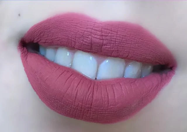 Juliana Lips w Teeth.jpeg