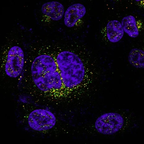 Immunofluorescent image of an Hs578t cell