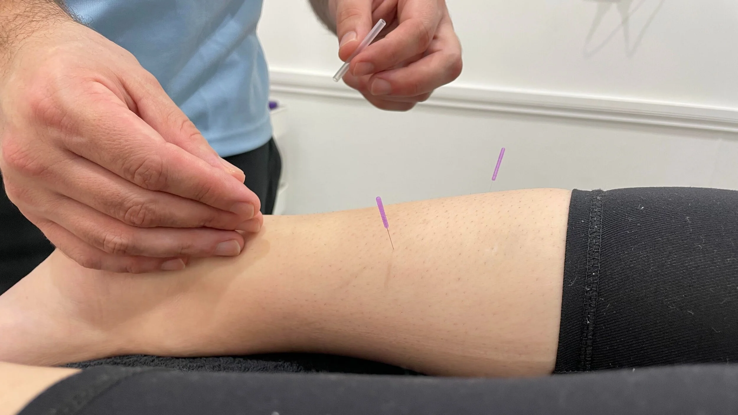 Physiotherapy Canterbury.jpeg