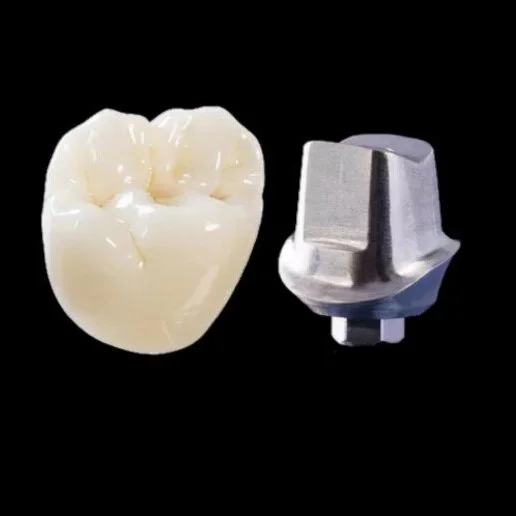 Choosing an Abutment Package — Hopetown Dental Lab