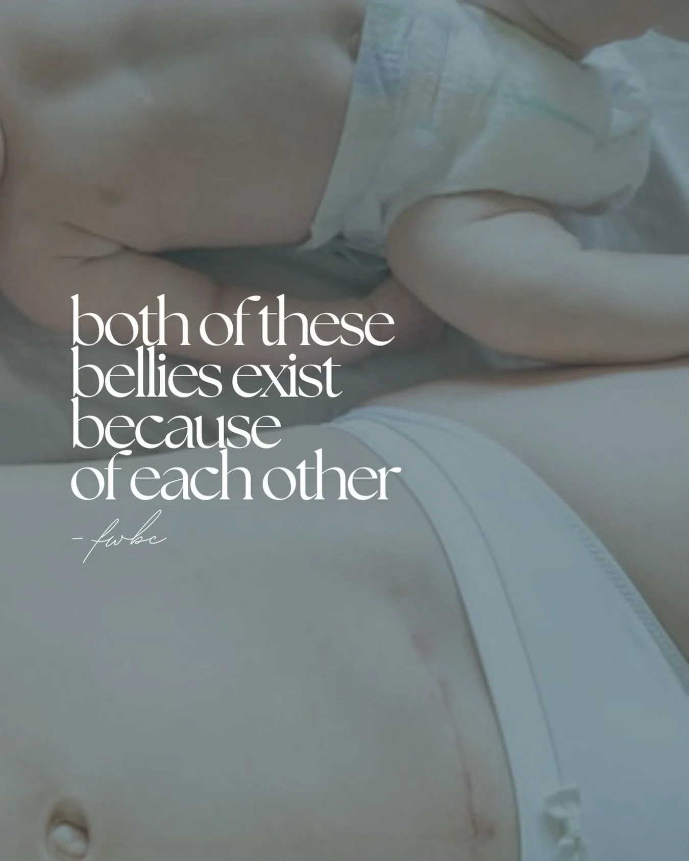 April is Cesarean Awareness Month 🤍

Every birth story looks different, and every path to meeting your baby deserves to be acknowledged and respected. Cesarean births are a vital and sometimes necessary part of maternity care. 

This month, we recog