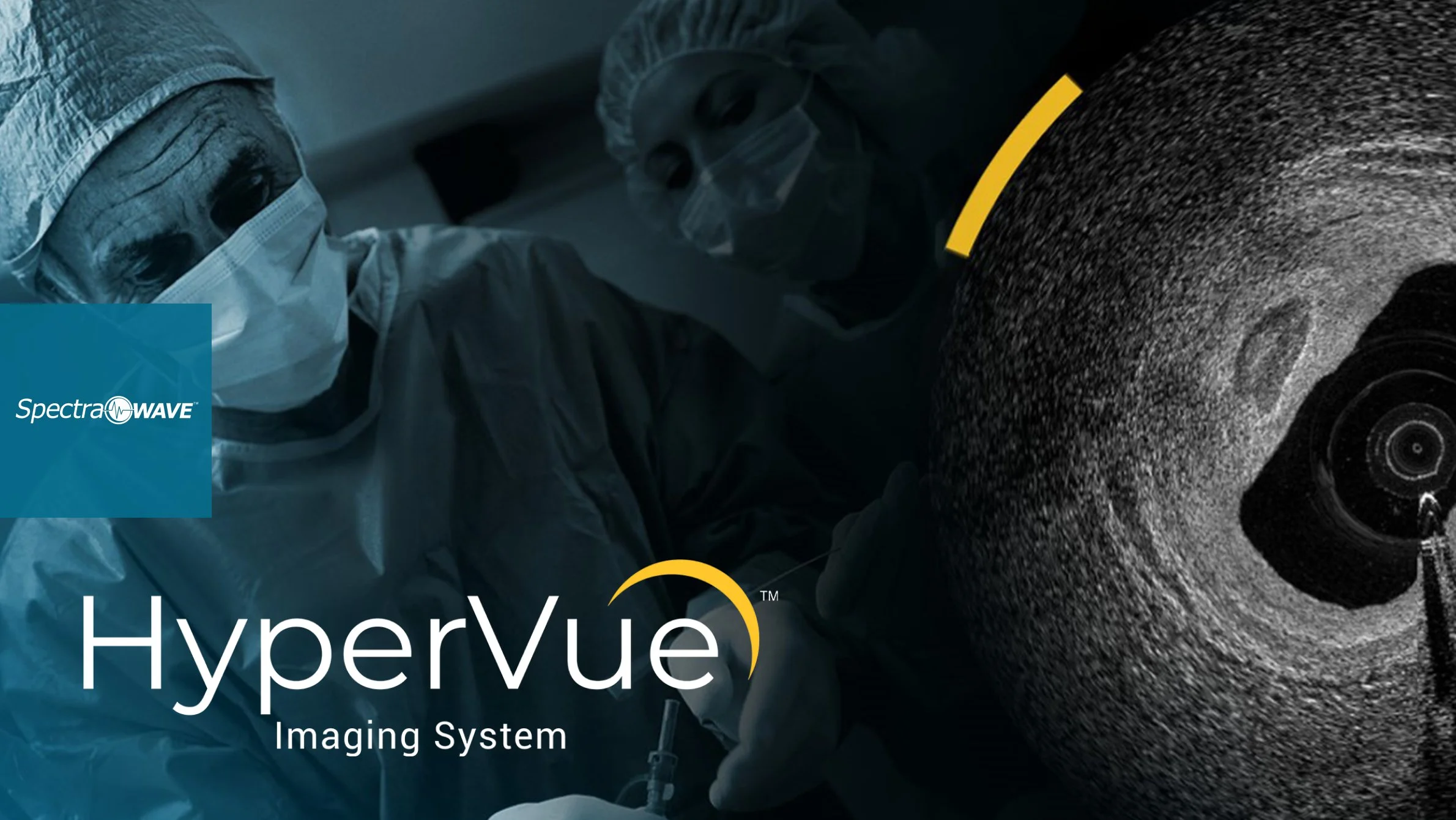 Hypervue SpectraWAVE — S3 Ventures: The Largest Venture Capital Firm Focused on ...