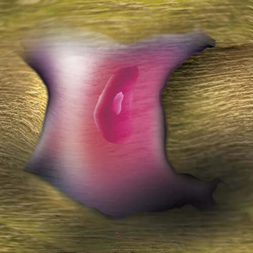 BONE CELL & BONE REDDER  blurred 500p.jpg