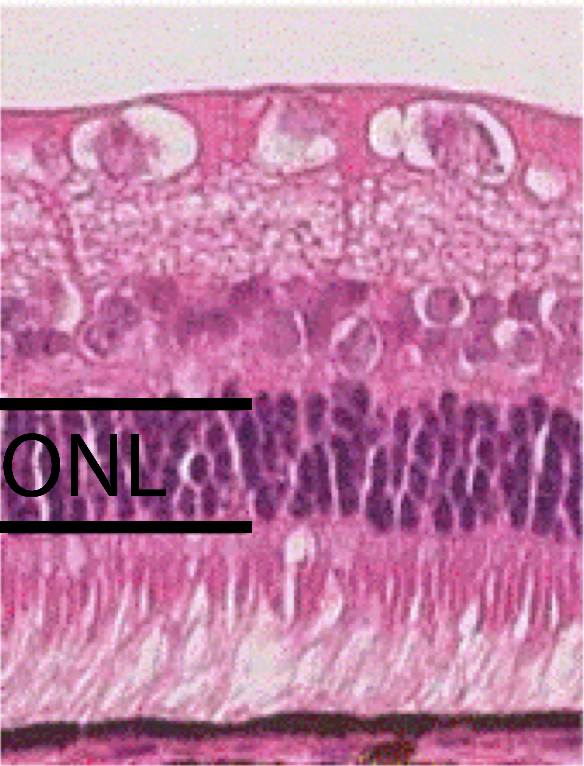 cyanthox eyes and vision retina 2.png