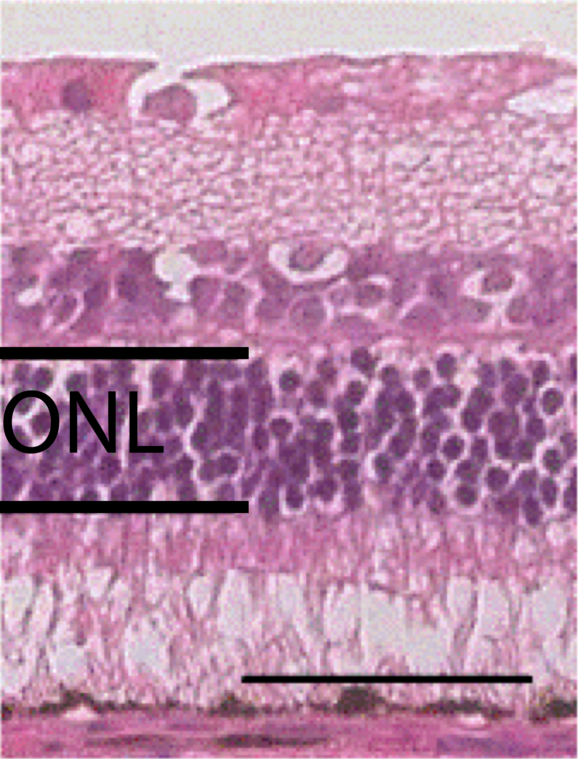 cyanthox eyes and vision retina 4.png
