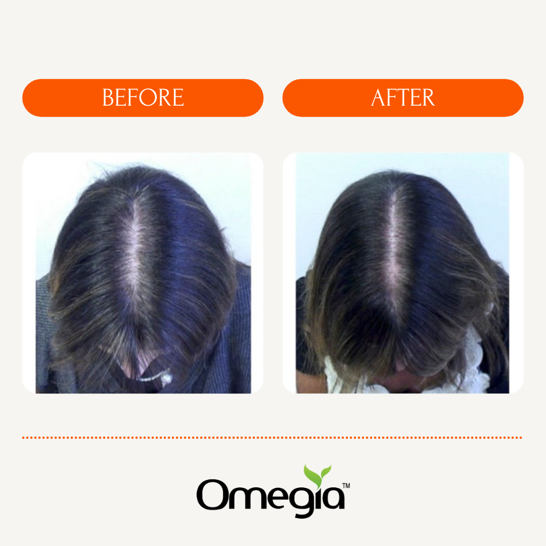 Hair and Skin Rejuvenation: Why Omega 7 is a Game Changer