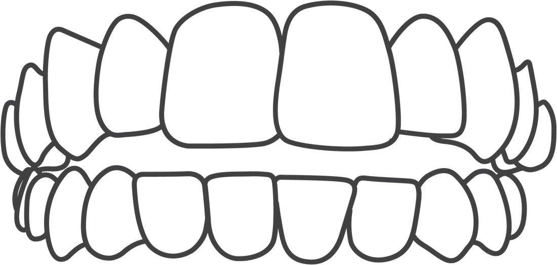 Invisalign treats open bites.