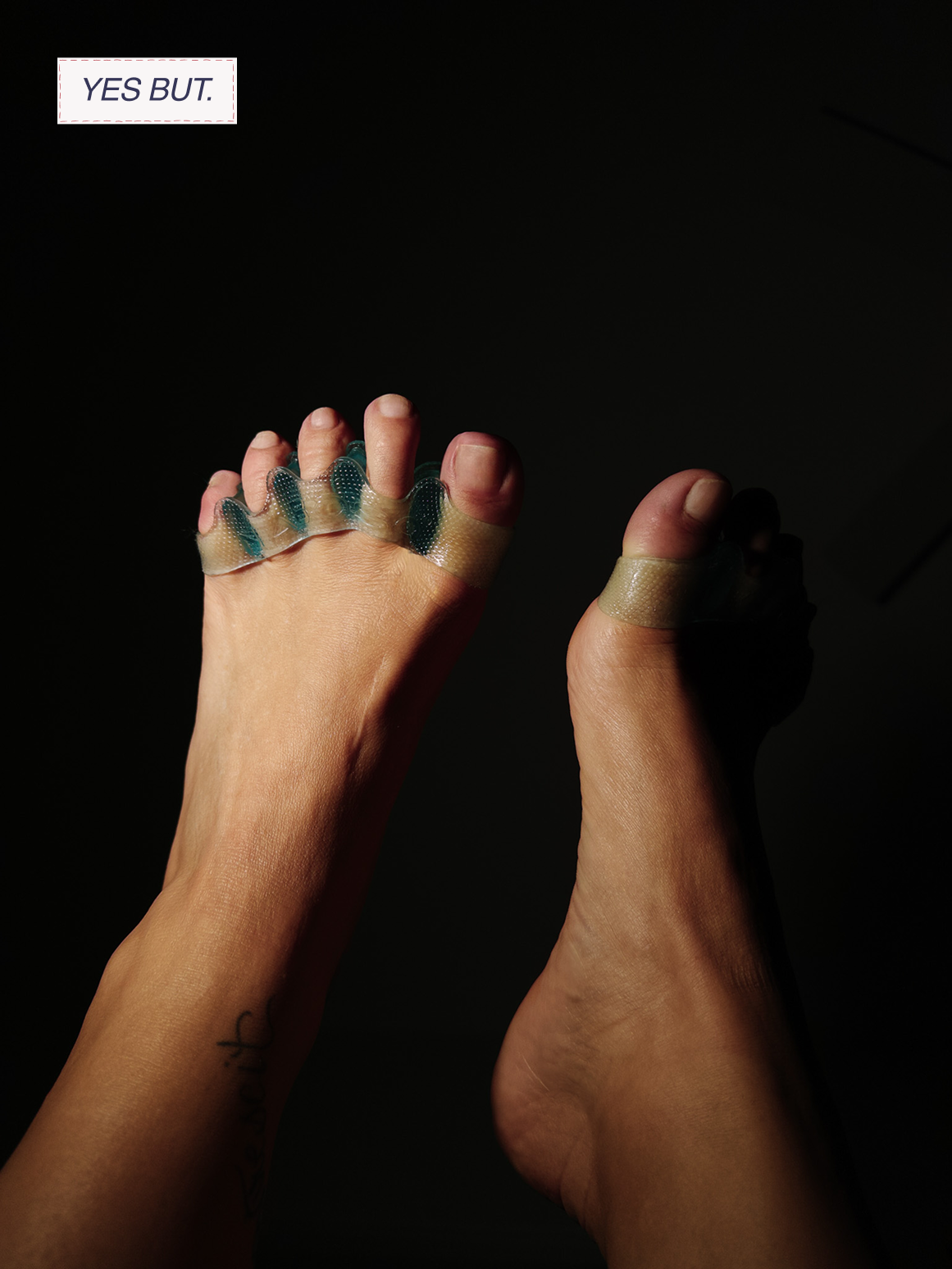 Two hands with fingers raised, wrapped with medical tape and finger splints for a hand injury, against a dark background.