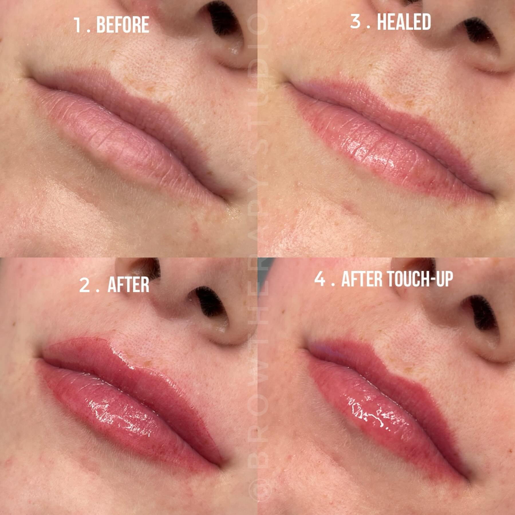 Beautiful soft blushed lips are the way to go. The goal is to create the perfect shade of pink to make your lips look more youthful with the Lip Blushing technique. 

𝘽𝙤𝙤𝙠 𝙮𝙤𝙪𝙧 𝙖𝙥𝙥𝙤𝙞𝙣𝙩𝙢𝙚𝙣𝙩 𝙩𝙤𝙙𝙖𝙮 𝙬𝙞𝙩𝙝 𝙤𝙣𝙚 𝙤𝙛 𝙤𝙪𝙧 𝙨?