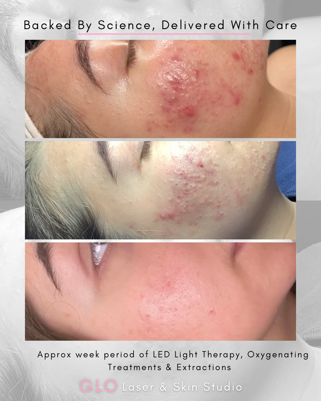 Copy of week 3 Thu - Before & After - Horizontal.png