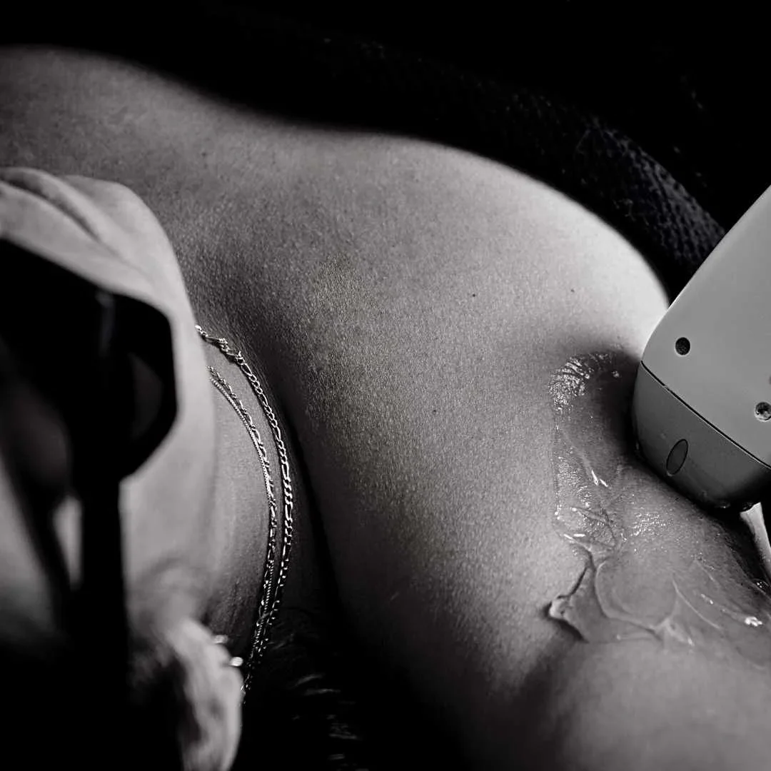 Discover Smooth, Confident Skin with the Best Laser Hair Removal