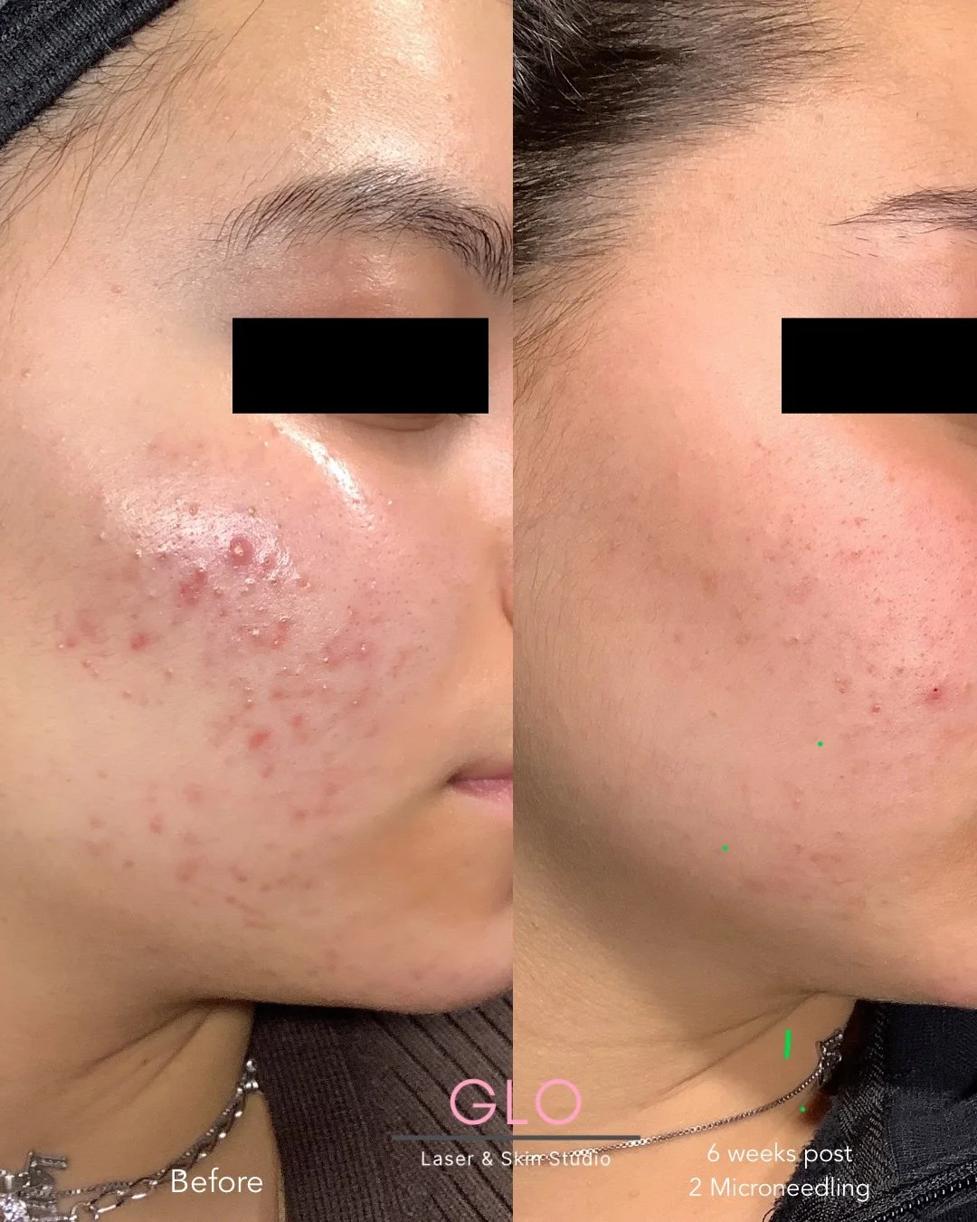 Jan 15 - b & A - 1.jpeg