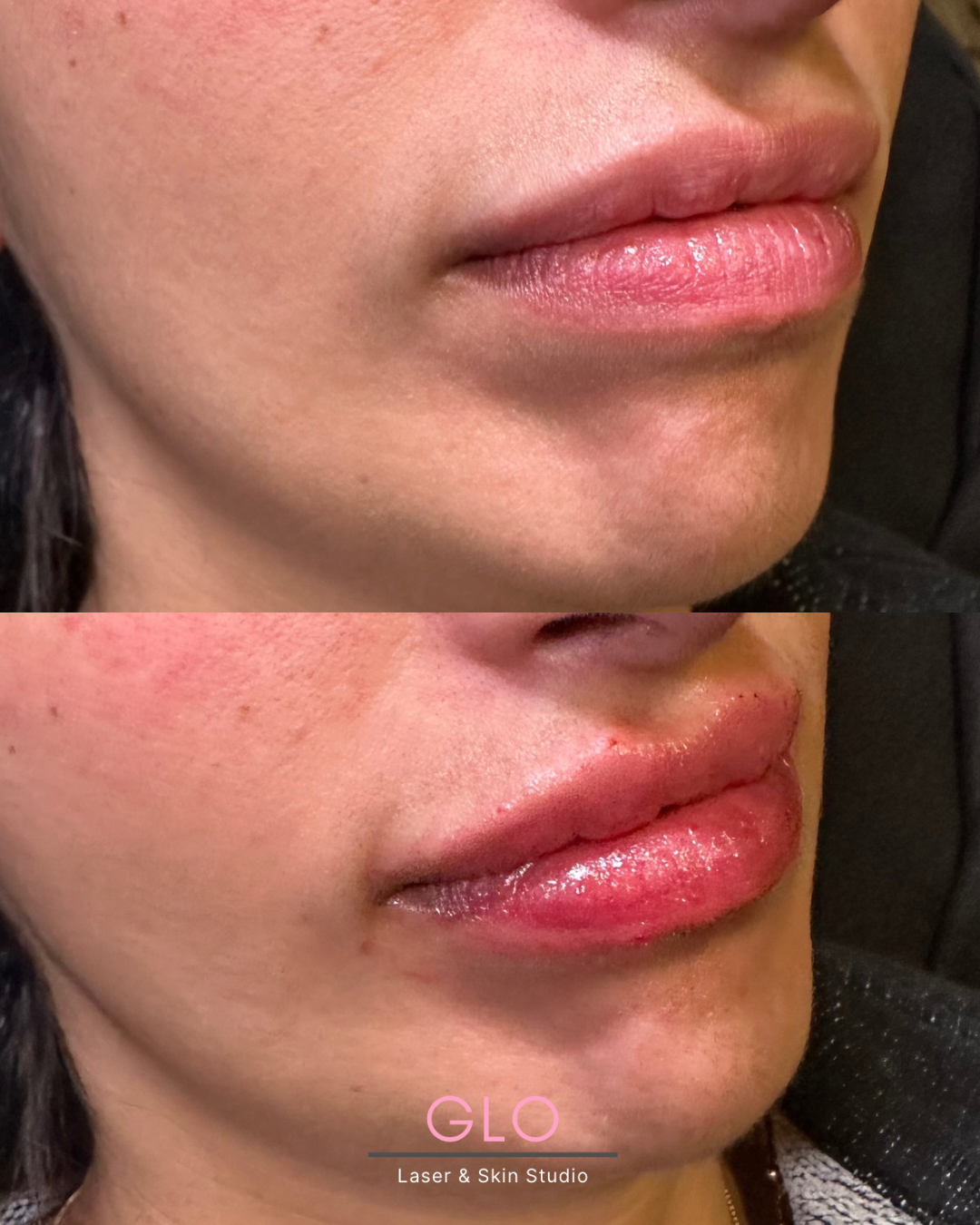 Feb 5 - B &A - 1.png