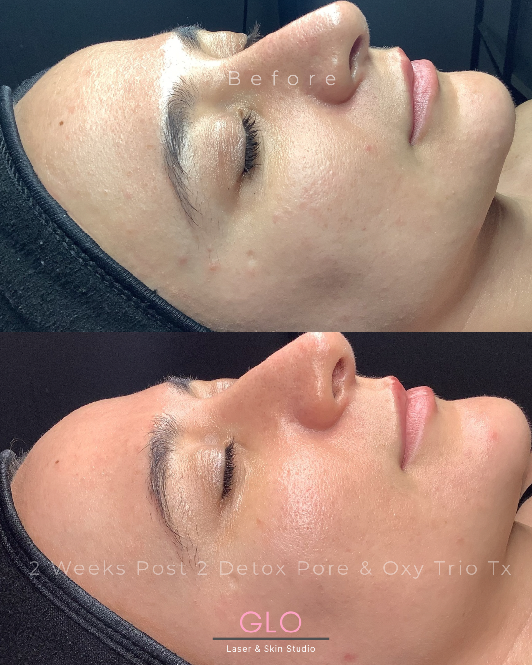 **B & A Template.png