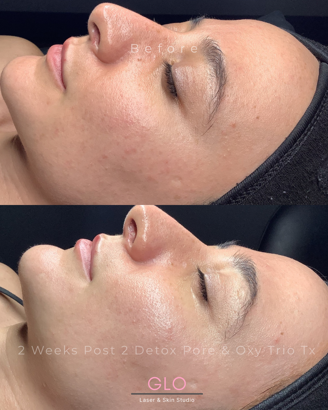 2. Copy of  B & A.png