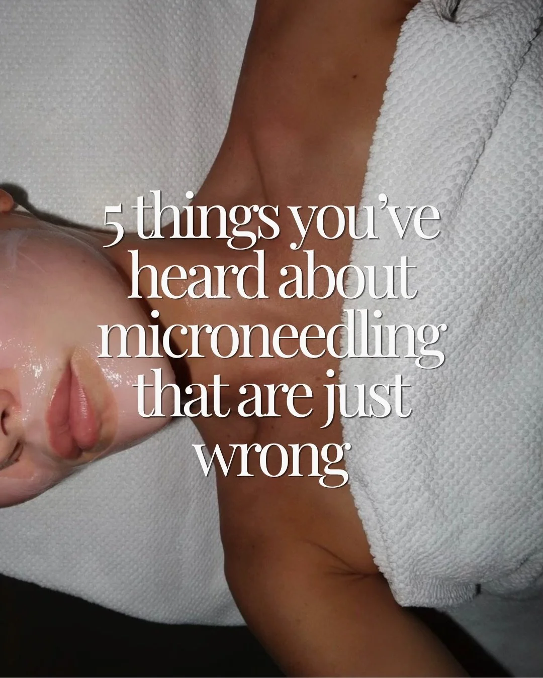 We&rsquo;re debunking the 5 biggest myths we hear about it microneedling. Swipe to find out because one of these might be the reason you haven&rsquo;t booked yet👀

Questions? Drop them below or DM us! 

Link in bio to book your treatment🔗