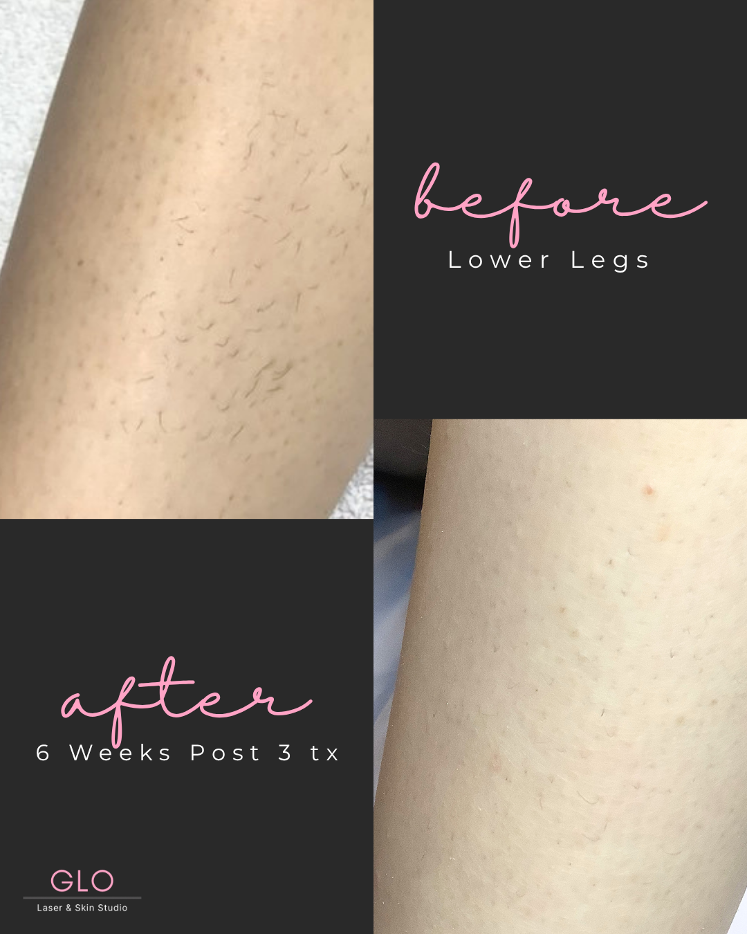 before &  afters.png