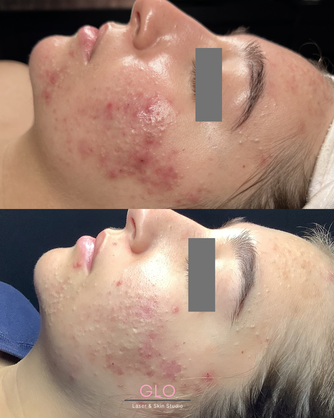 before &  afters - 1.png
