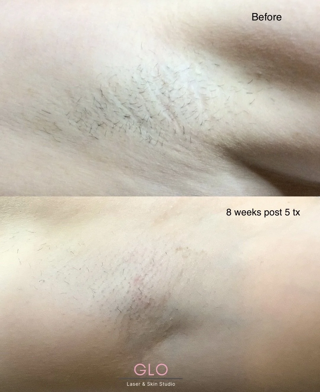 before &  afters - 1.jpeg