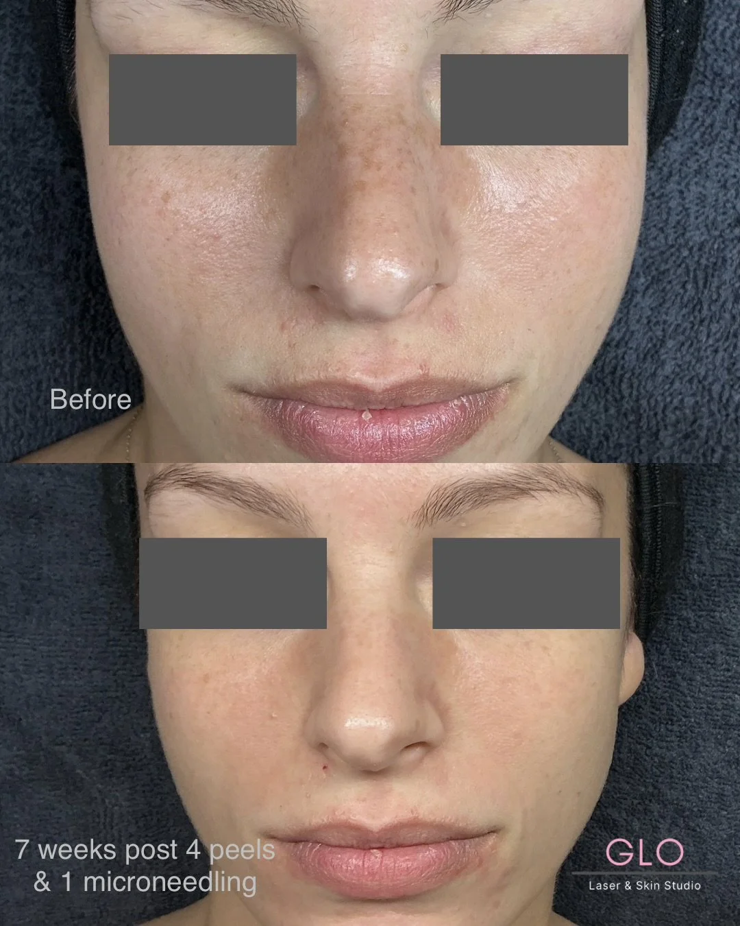before &  afters - 1.jpeg