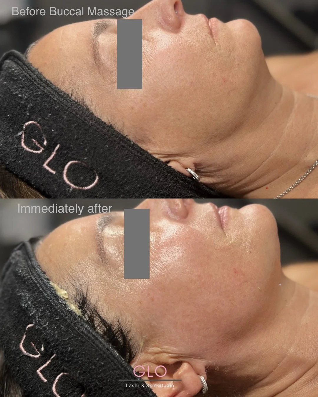 before &  afters - 5.jpeg