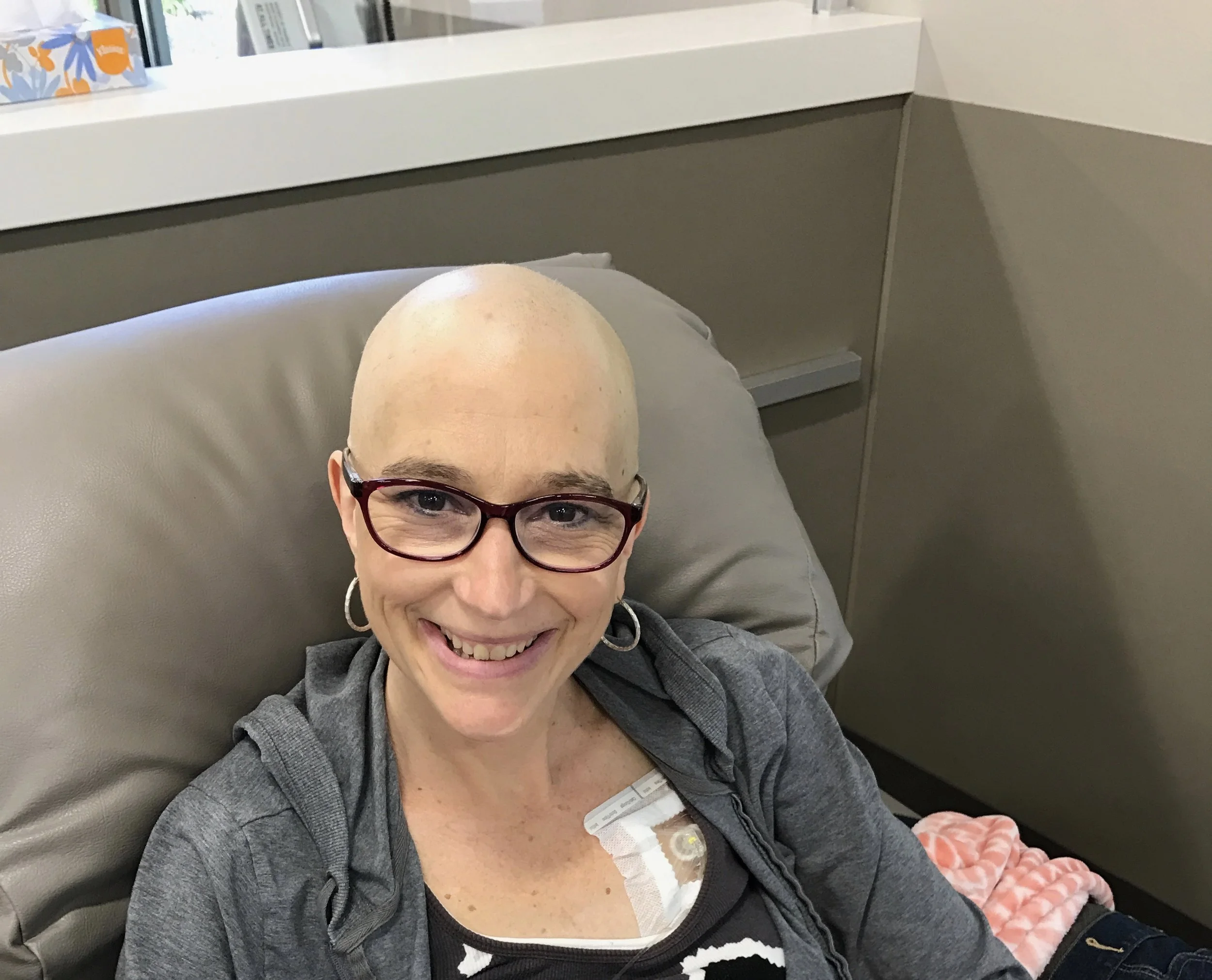 Hair?  Who Needs It?  