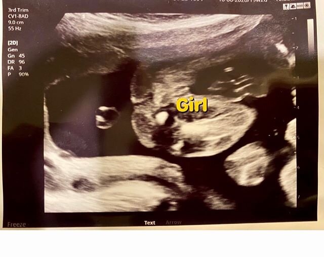 We didn&rsquo;t even discuss boy names because I knew it would be a girl! #GEESH! I&rsquo;m beyond excited and extremely blessed to be receiving one of the best things to ever happen in my life!!! #itsagirl #babygirl #excitedforthefuture