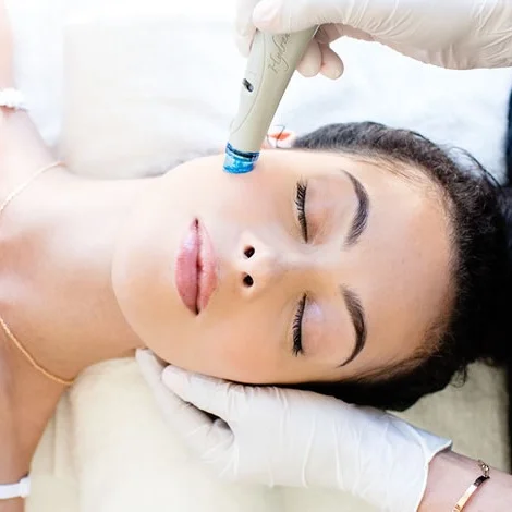 Hydrafacial_Treatment.jpg