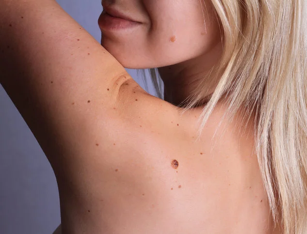 Brown Spot Stock.jpg