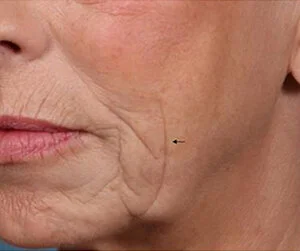 Tired of your wrinkles clinical trial.jpg