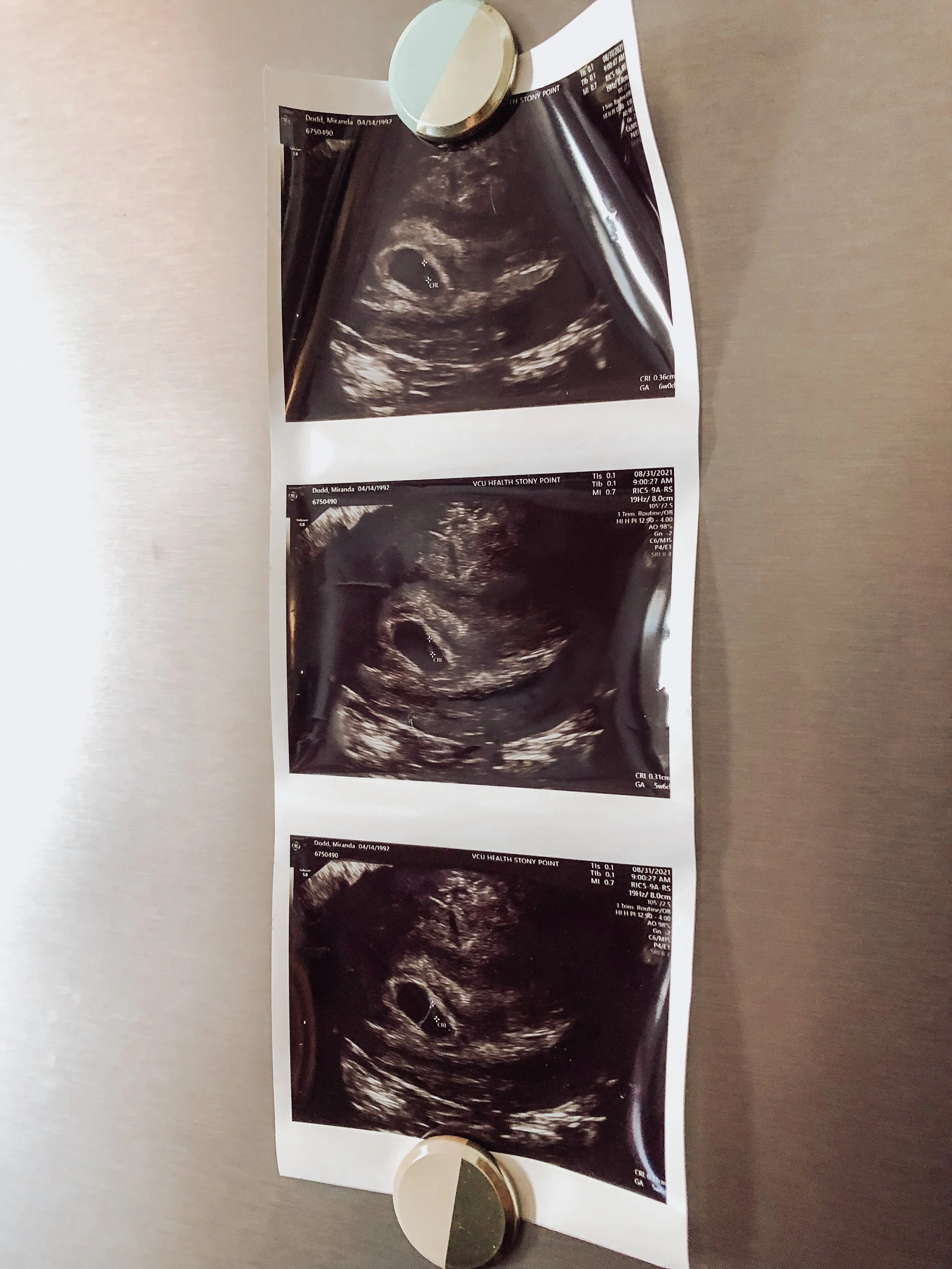 1st Trimester Essentials