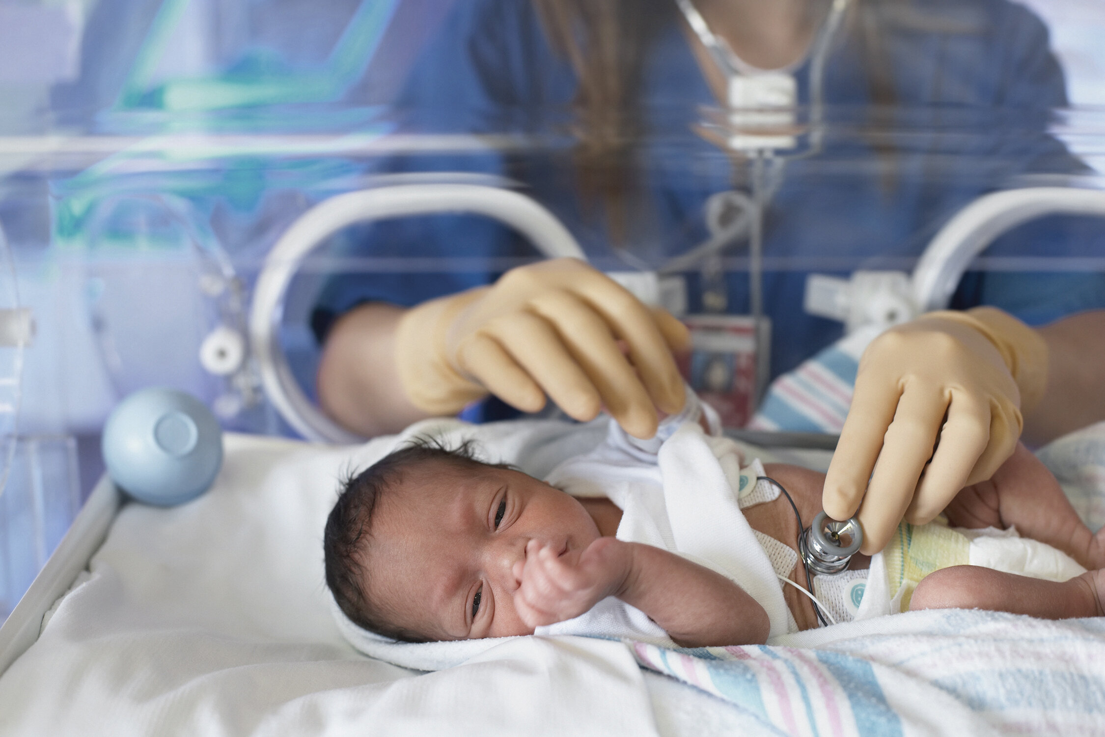 Preemies and language delay — Babbly