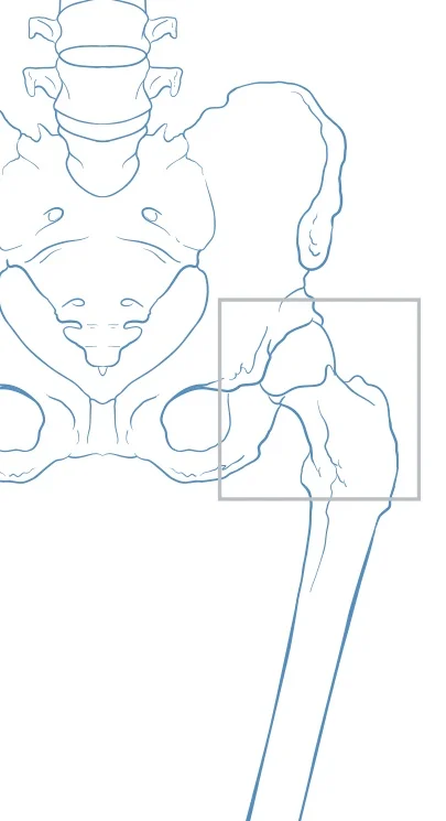 SURGICAL PROCEDURES &amp; CONDITIONS OF THE HIP