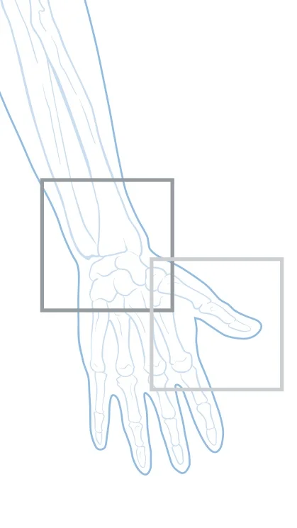 SURGICAL PROCEDURES &amp; CONDITIONS OF THE HAND &amp; WRIST