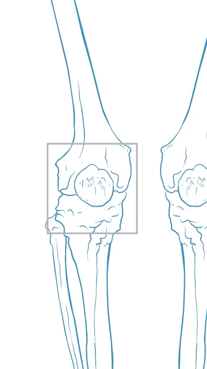 SURGICAL PROCEDURES &amp; CONDITIONS OF THE KNEE