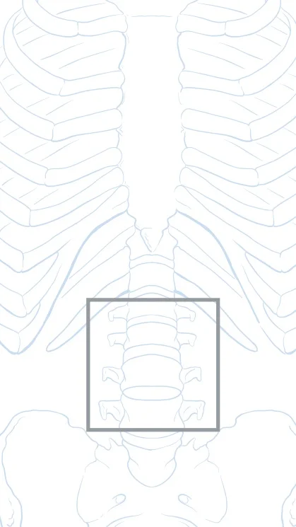 SPINAL DECOMPRESSION AND FUSION SURGERY 