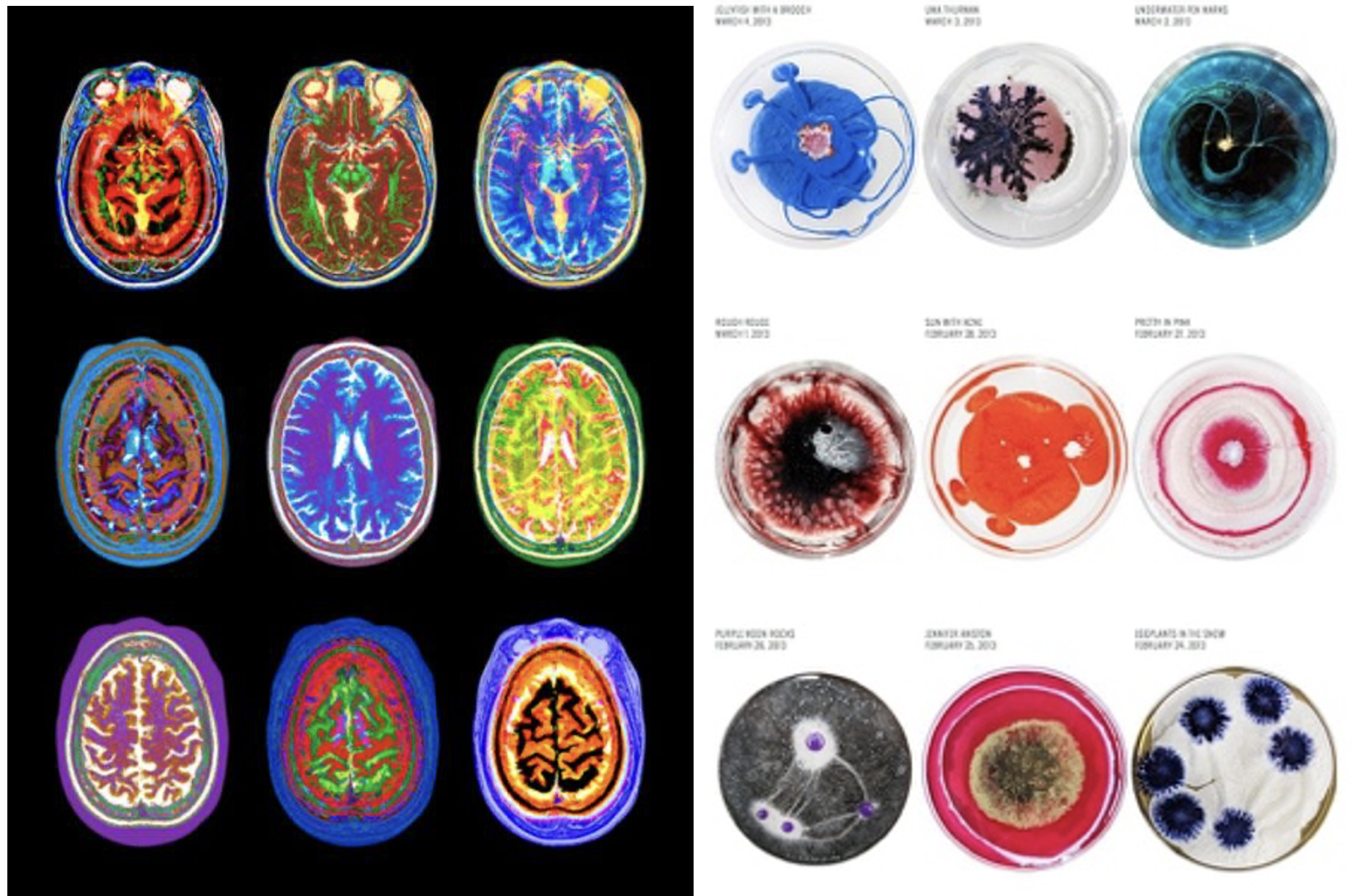 From multi-cell to complex neural system