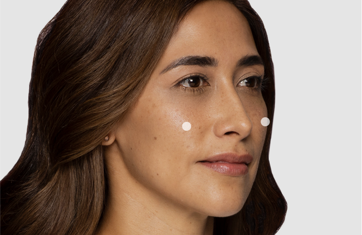 Restylane Contour Gains FDA Approval for Temple Hollowing
