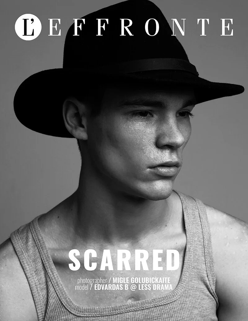 Scarred by Migle Golubickaite