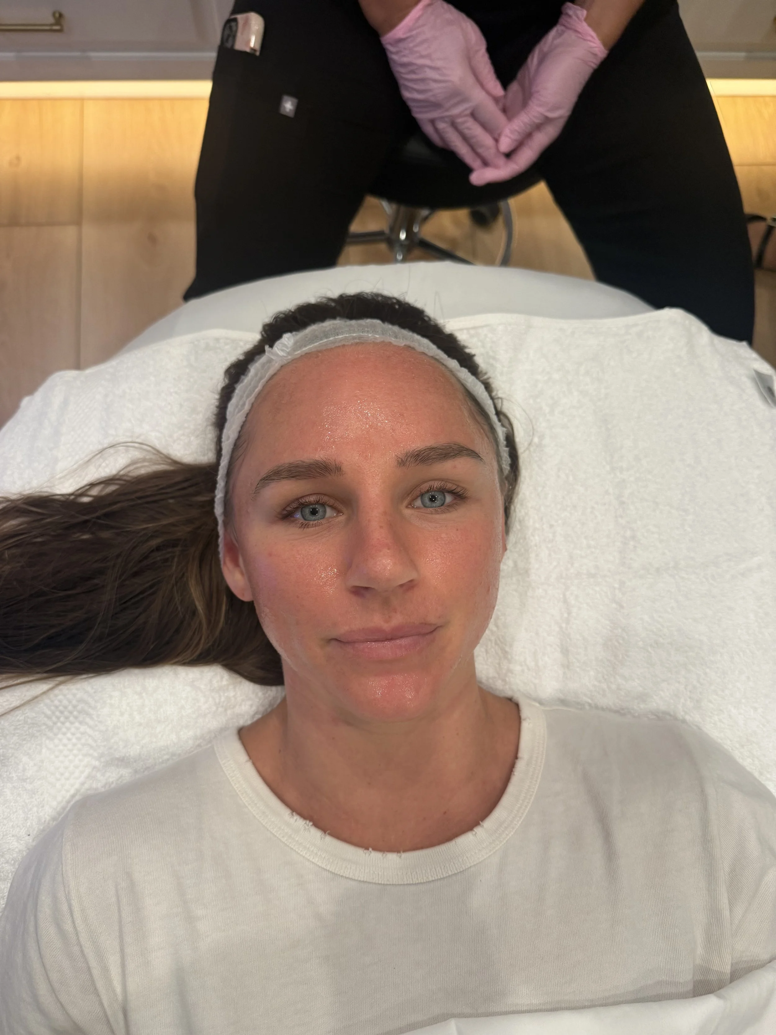 After HydraFacial with glowing skin
