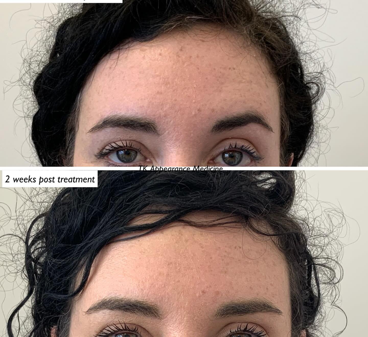 The brief&hellip;..&rsquo;please make my eyebrows more even&rsquo;
So thats what we did! ☺️
