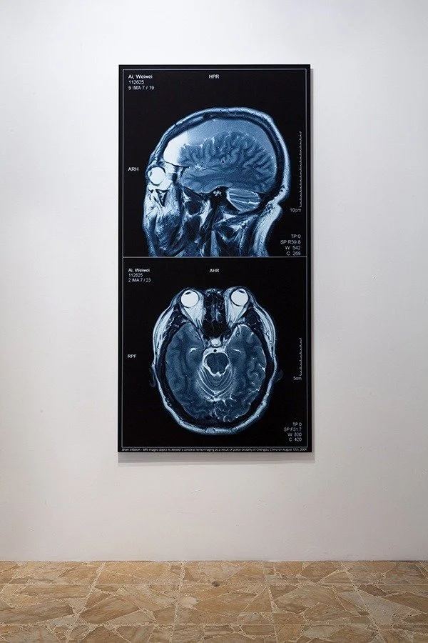 Ai wei wei - Brain Inflation 2009.jpg