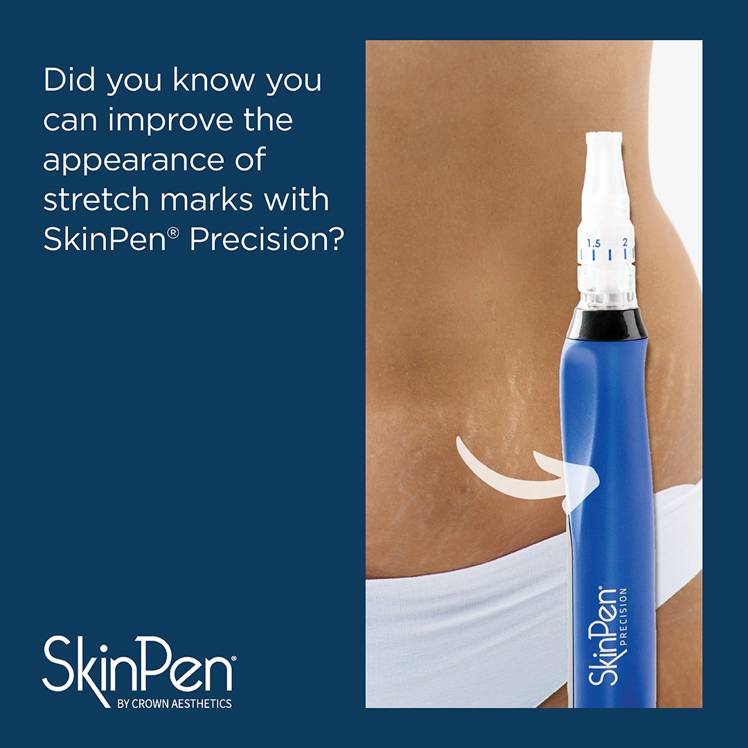 Micro Needling — The Dermal Health Alliance