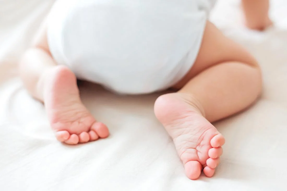 baby-in-diapers-who-may-have-a-rash.jpg
